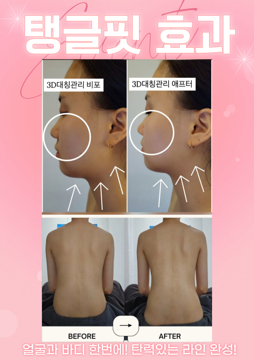 서윤피부맑음 명동점 대표 이미지