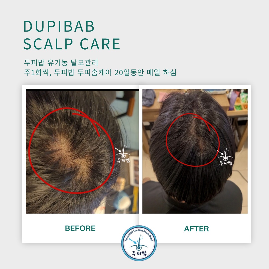 두피밥 화성시청점 대표 이미지