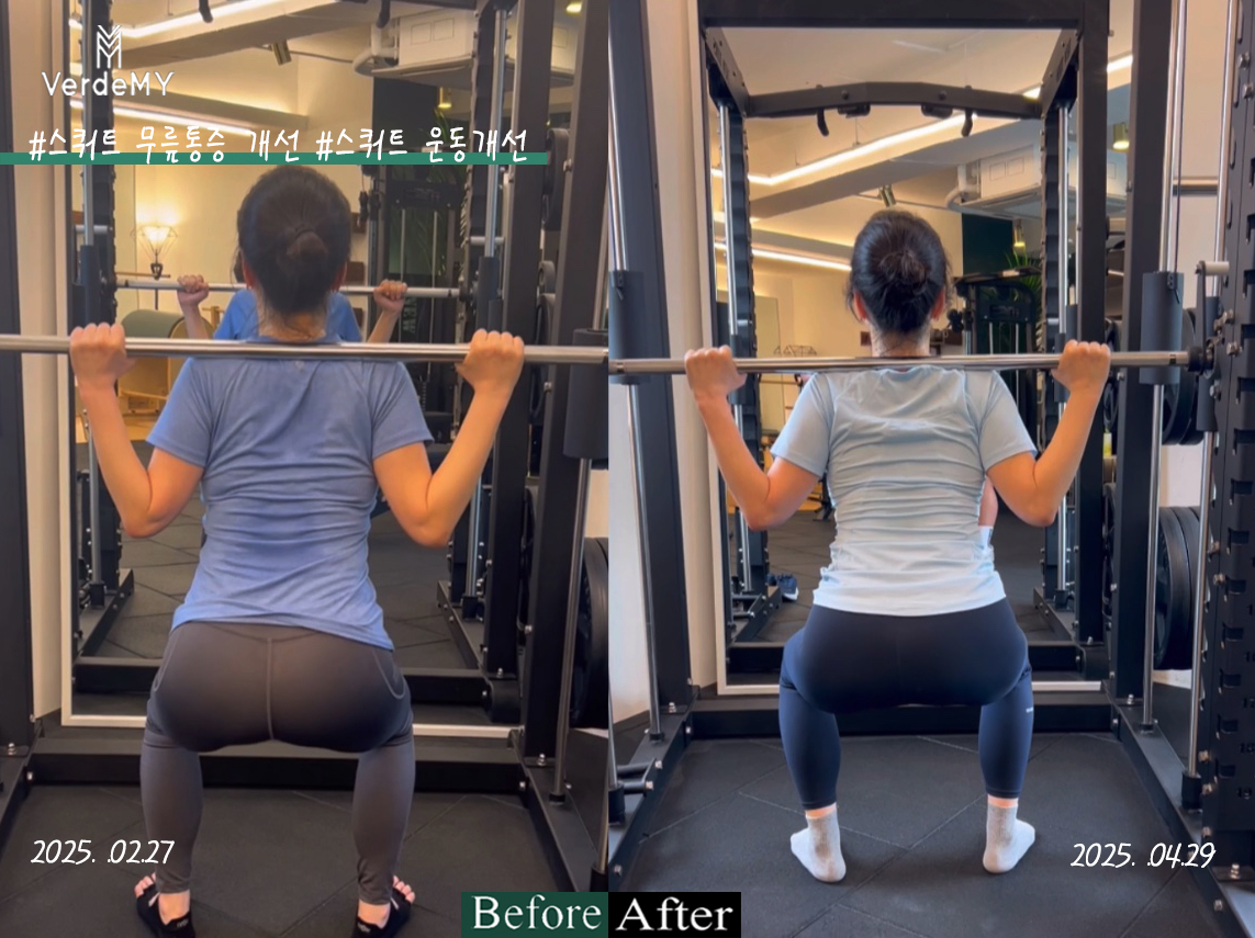 베르데미 대표 이미지