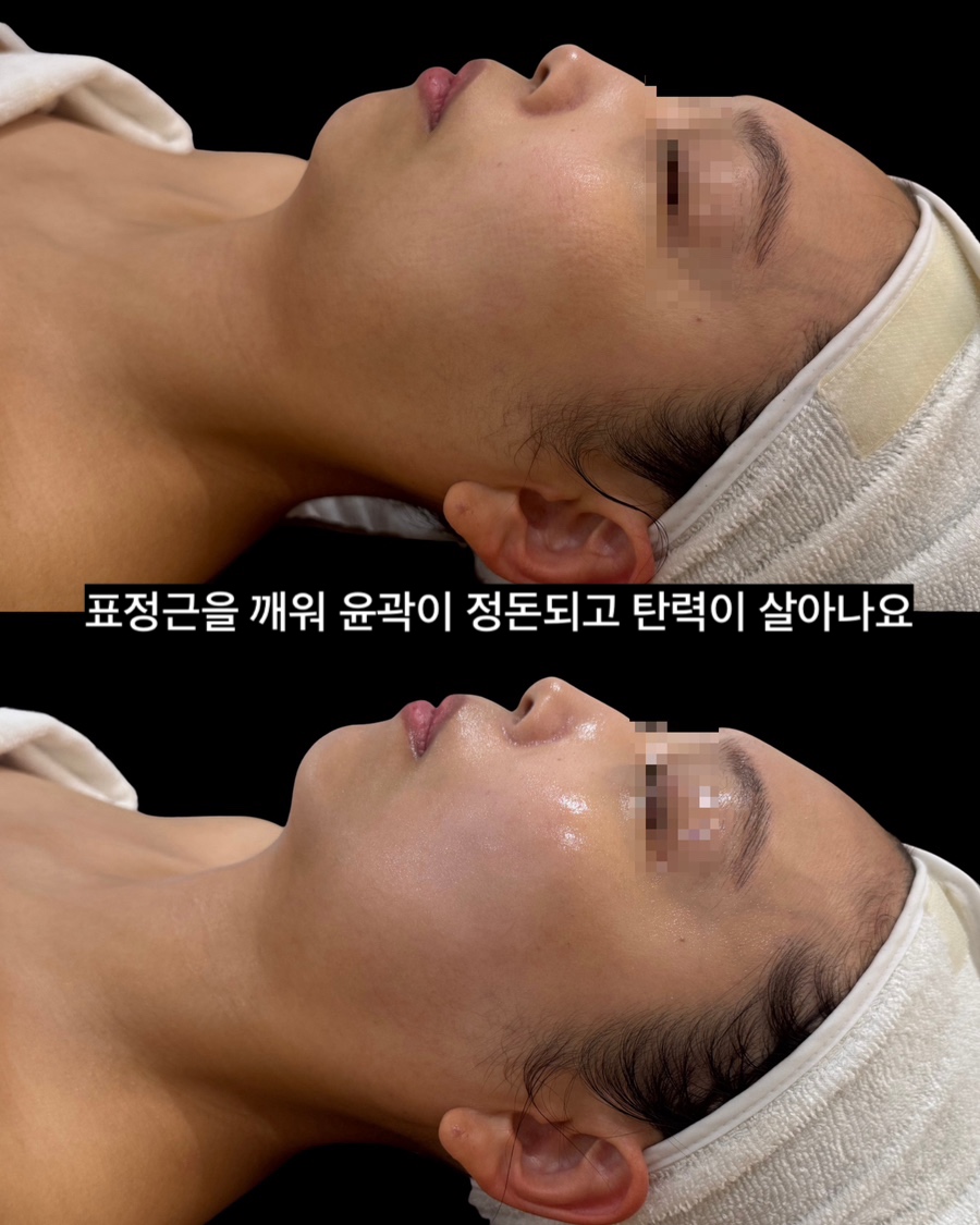 벨보뜨테라피 수유미아본점 photo 2