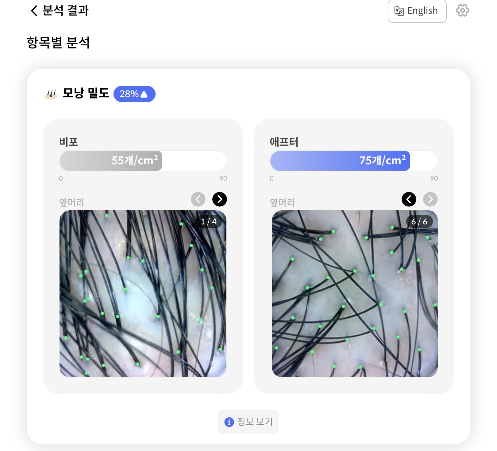 그로우 두피탈모 헤드스파 대전유성점 대표 이미지