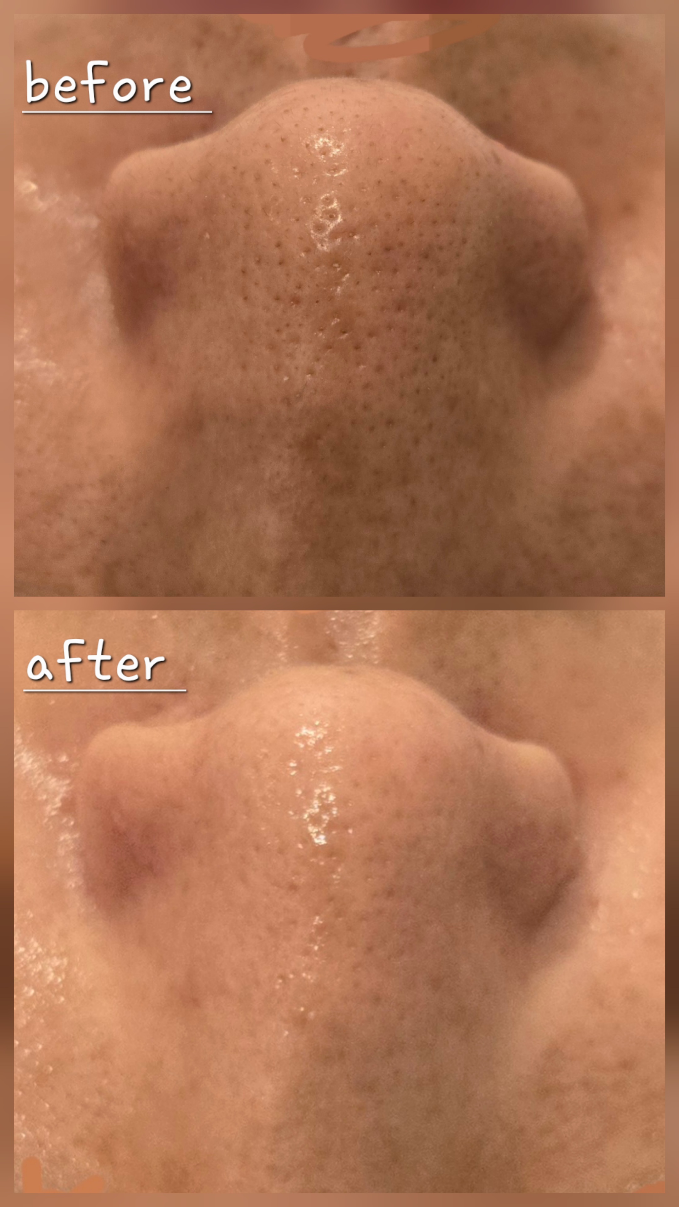 고원장의모공세척테라피 원주점 대표 이미지