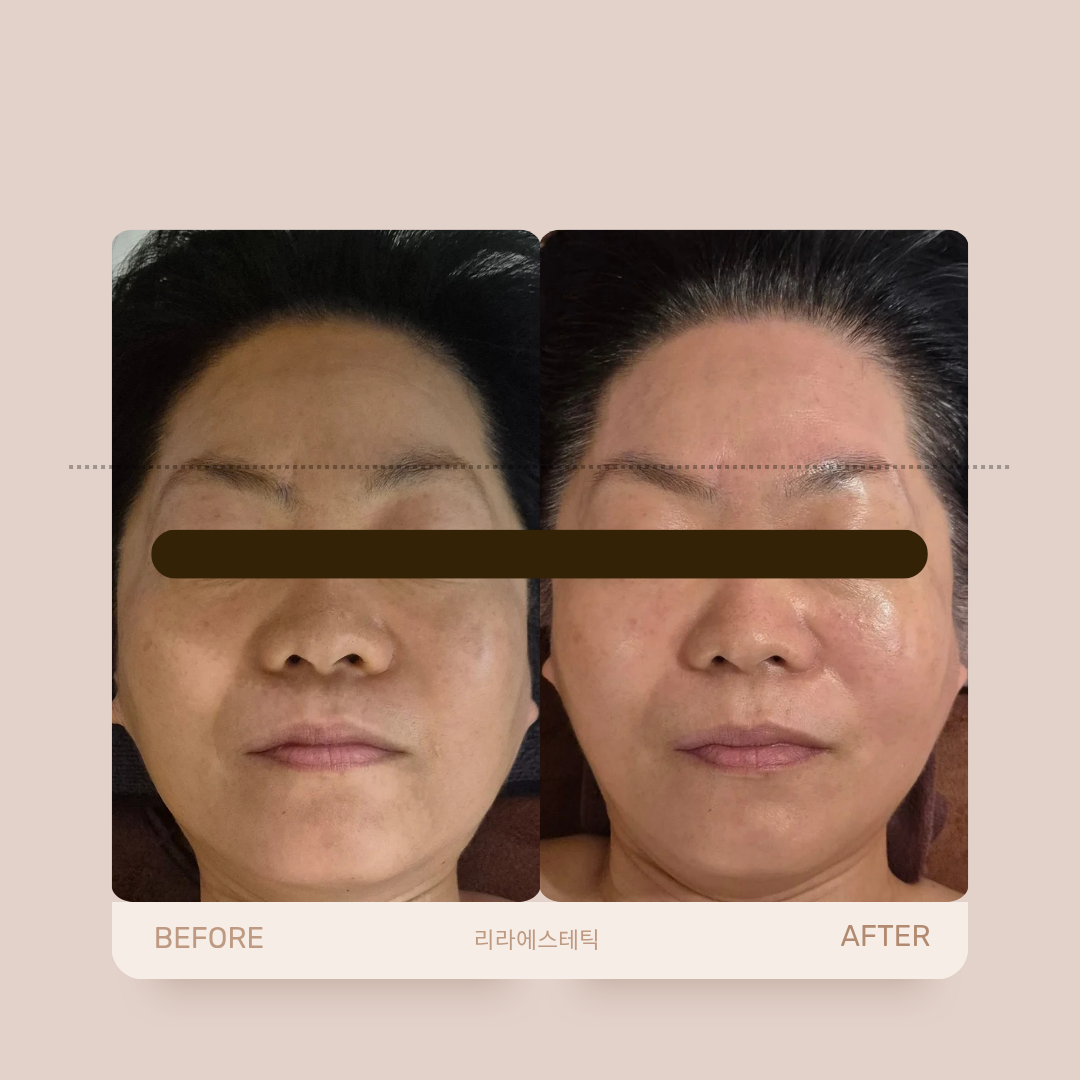 리라에스테틱 대표 이미지