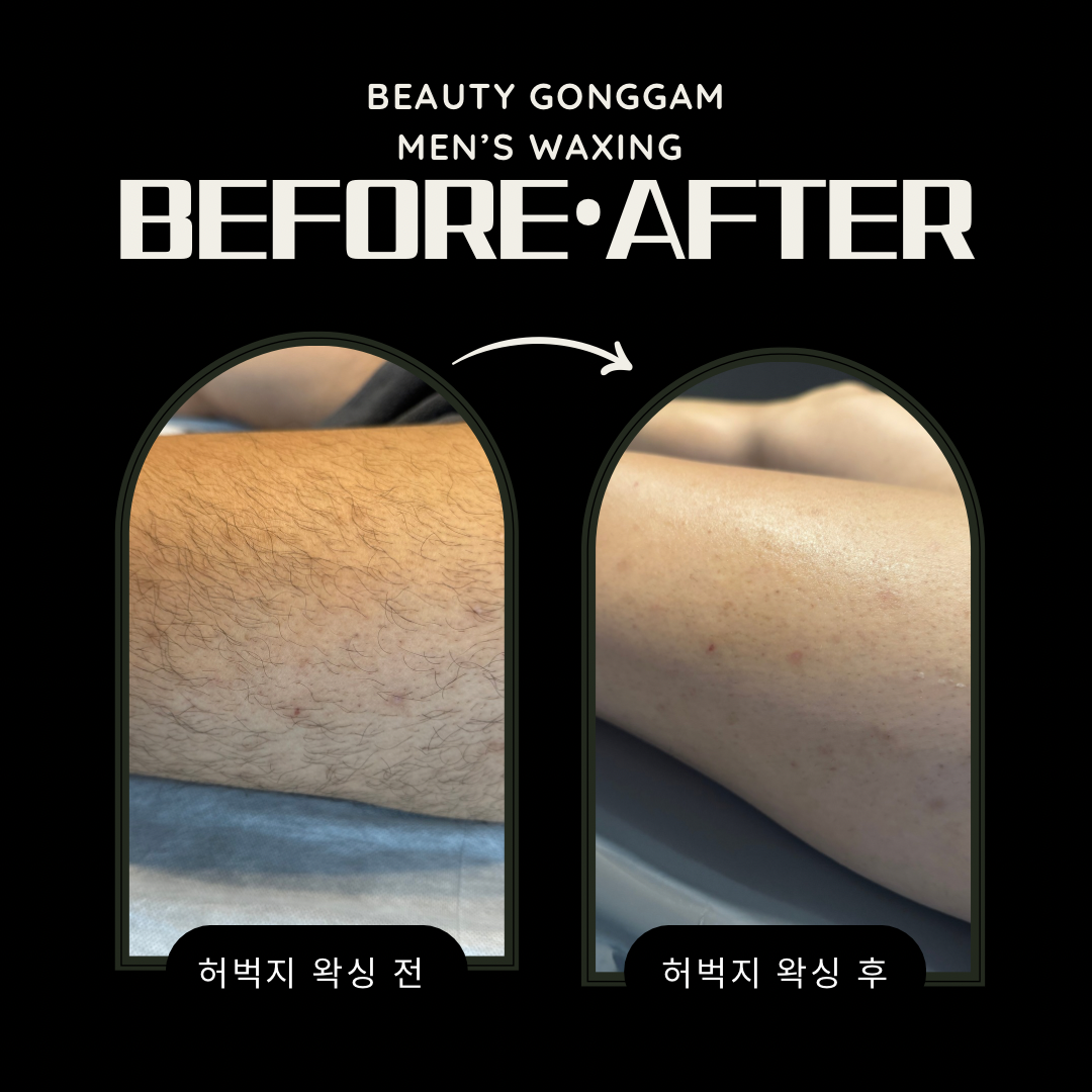 뷰티공감 스칼프 대표 이미지