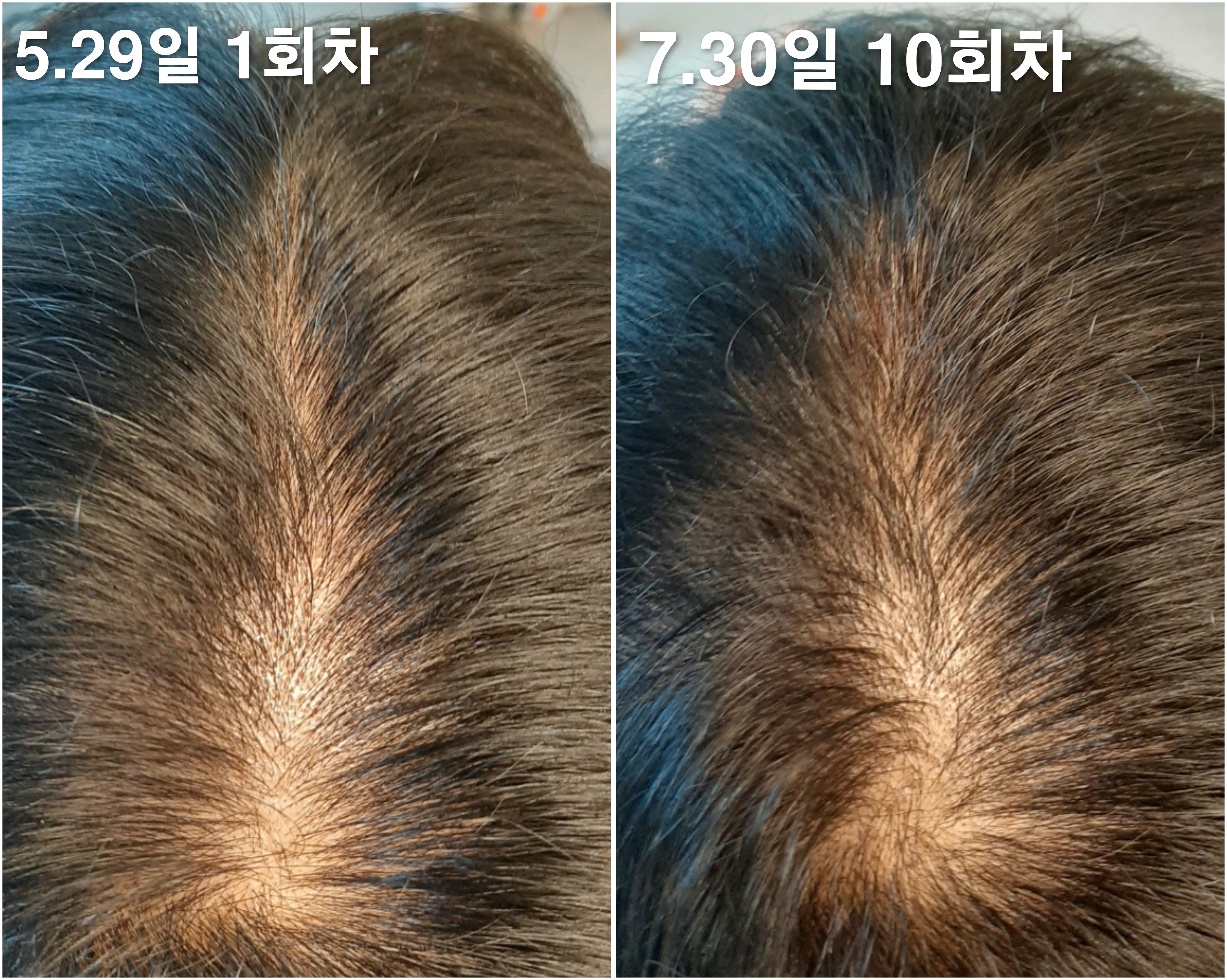 숲칼프 가산두피탈모전문센터 대표 이미지