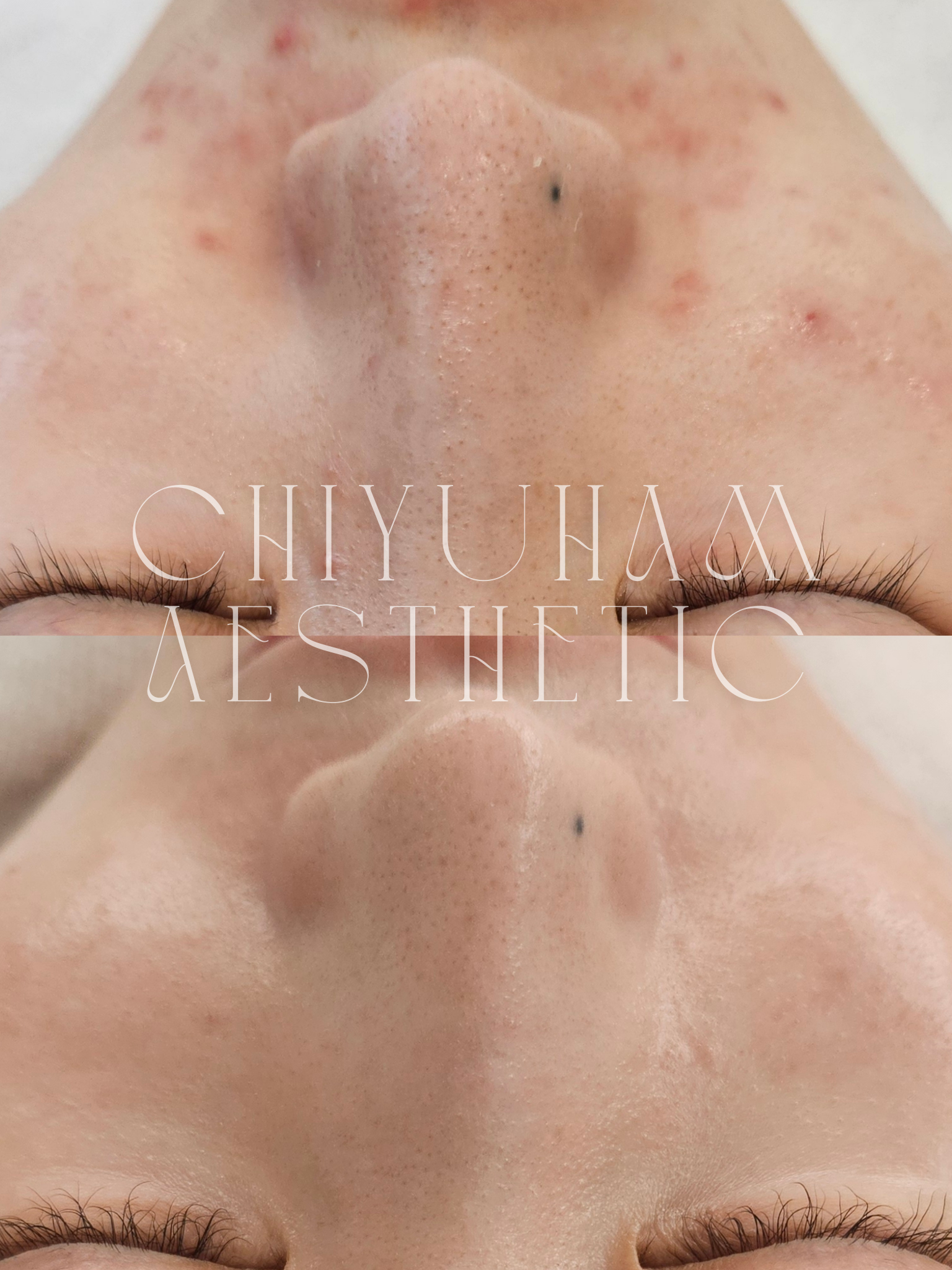 치유함에스테틱 대표 이미지