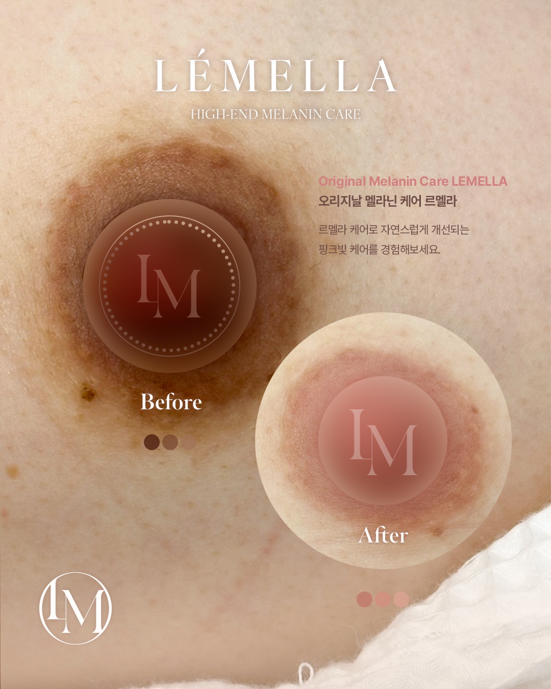 아나덴슈가링왁싱 남양주별내점 대표 이미지