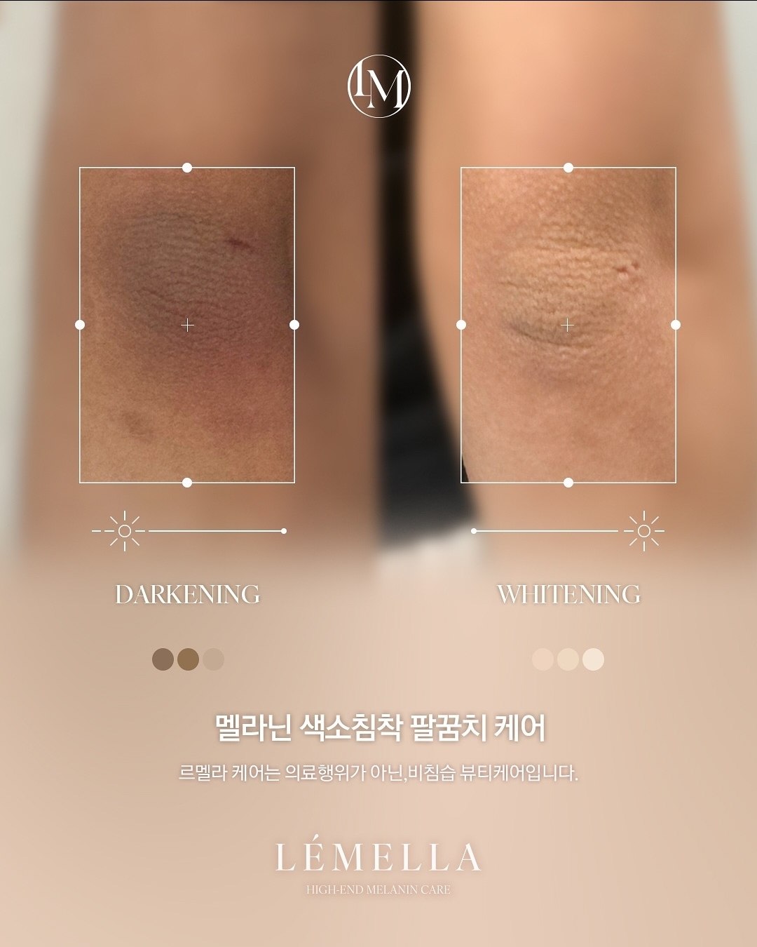 아나덴슈가링왁싱 남양주별내점 대표 이미지