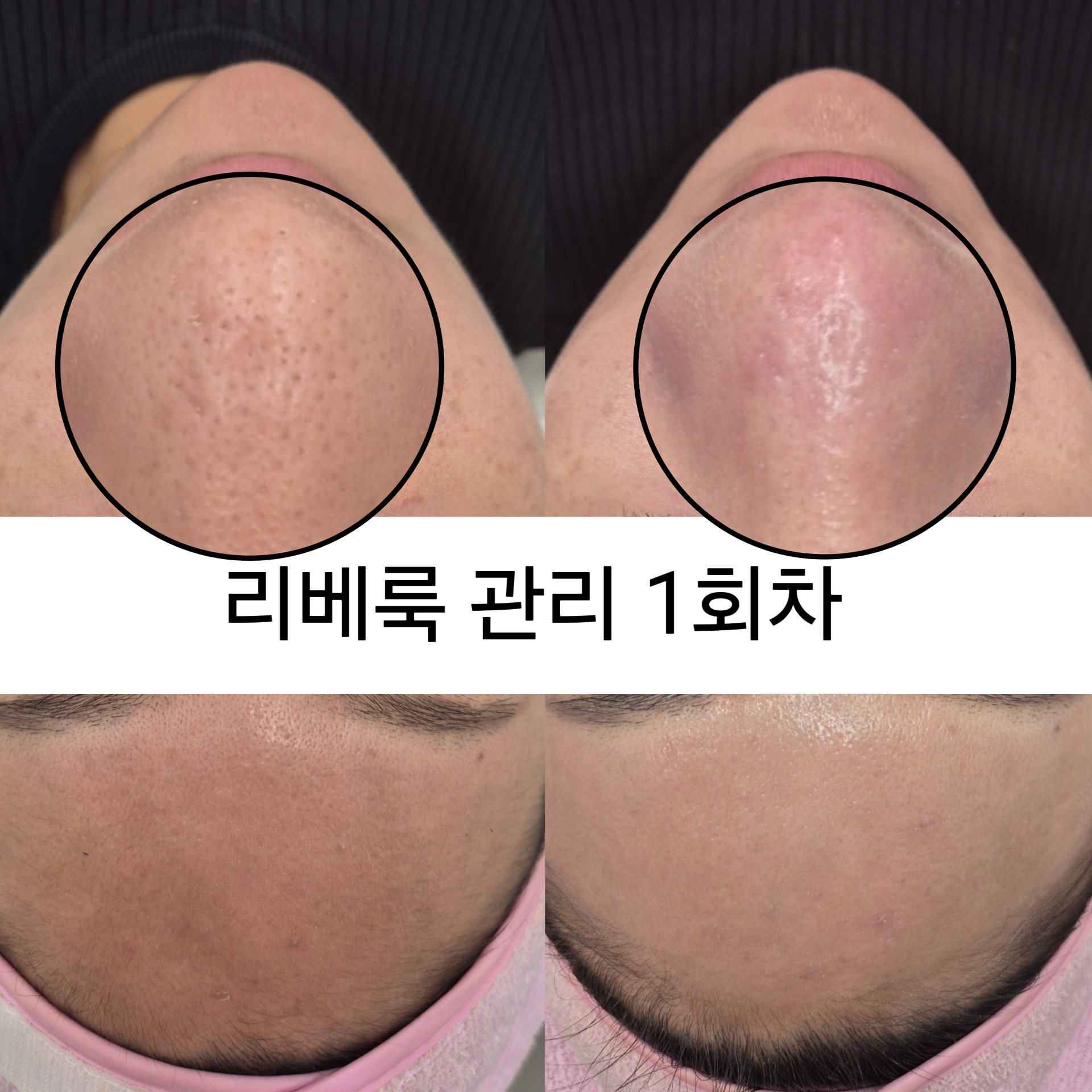 뷔쥬아 왁싱앤피부 대표 이미지