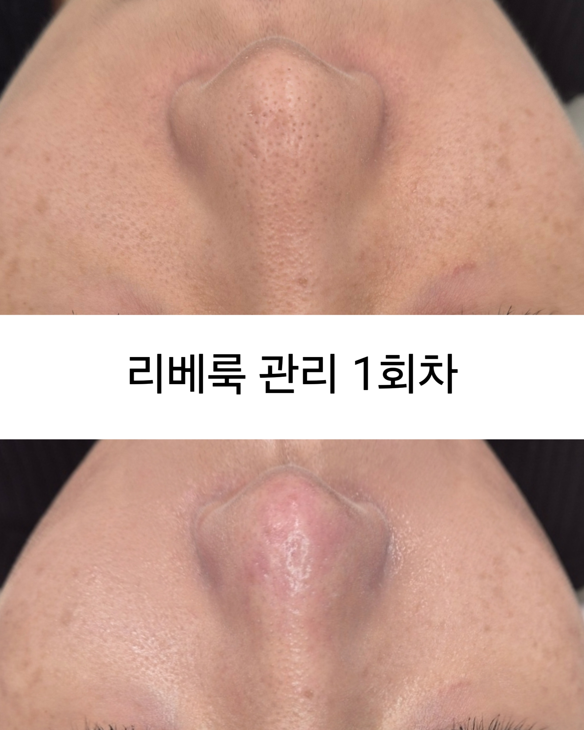 뷔쥬아 왁싱 대표 이미지