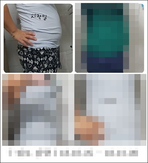 후