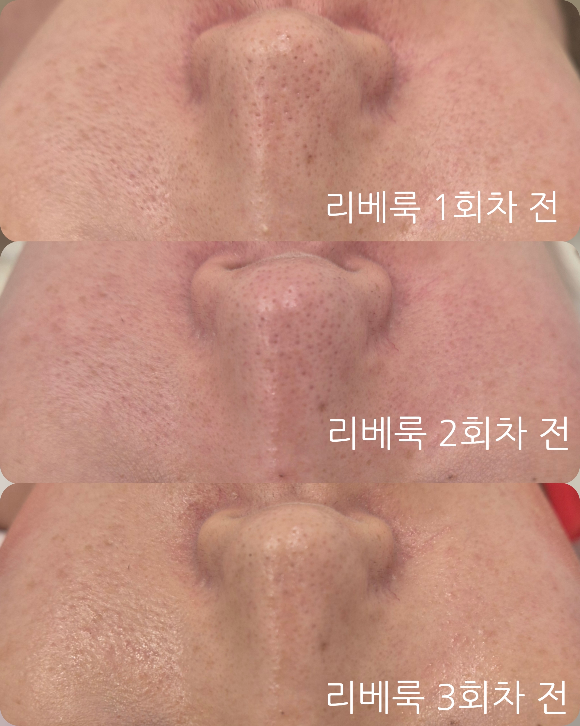 뷔쥬아 왁싱 대표 이미지