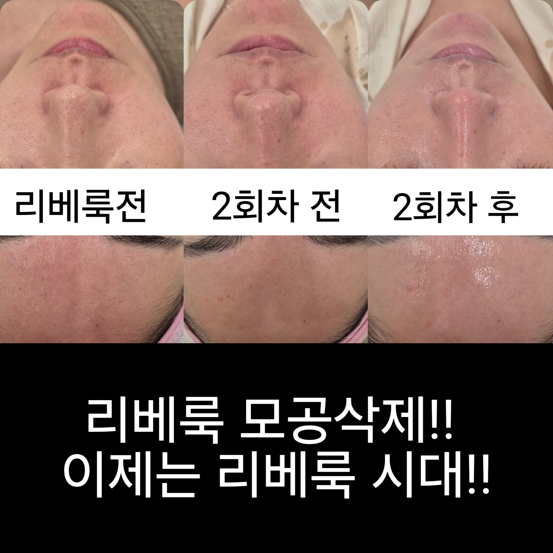 뷔쥬아 왁싱앤피부 대표 이미지