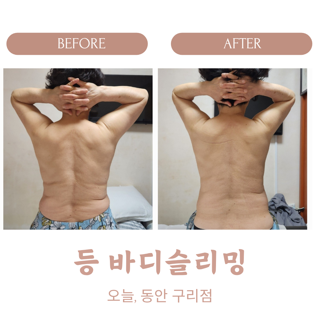 오늘, 동안 구리점 photo 5