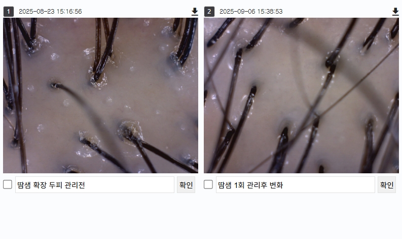 헤드스파 크리시모 대표 이미지