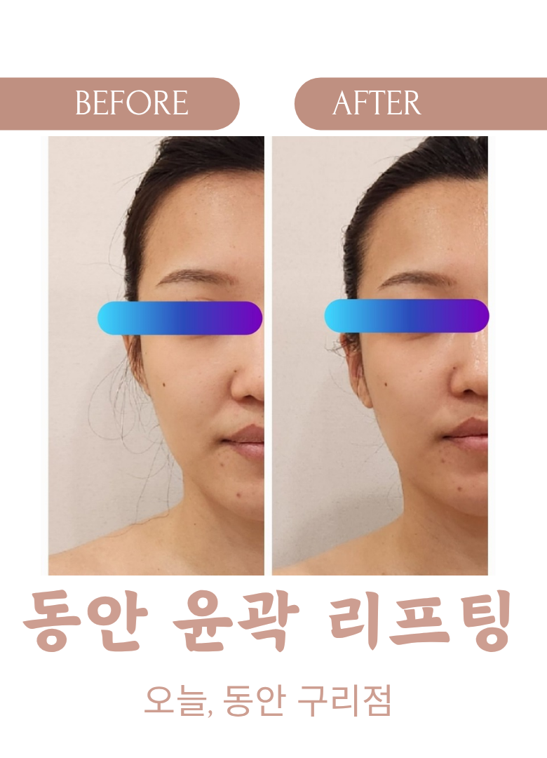 오늘, 동안 구리점 photo 6