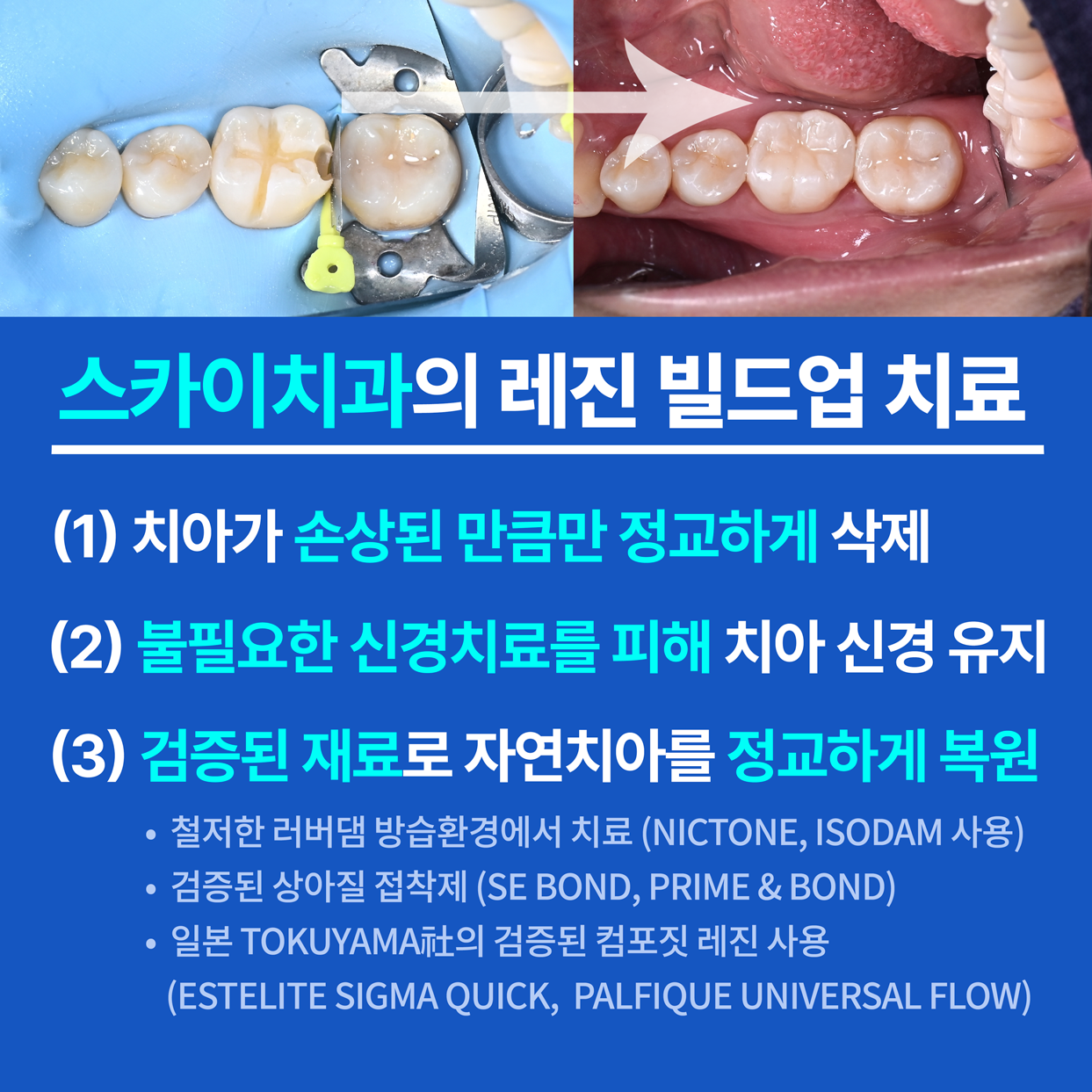 스카이치과 대표 이미지