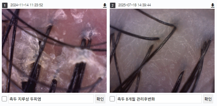 헤드스파 크리시모 대표 이미지
