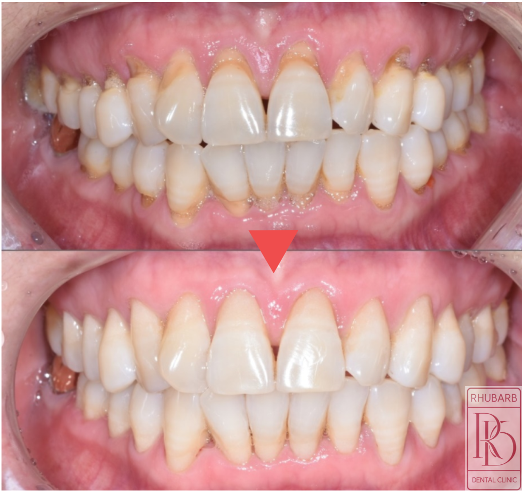 서울루바브치과 대표 이미지