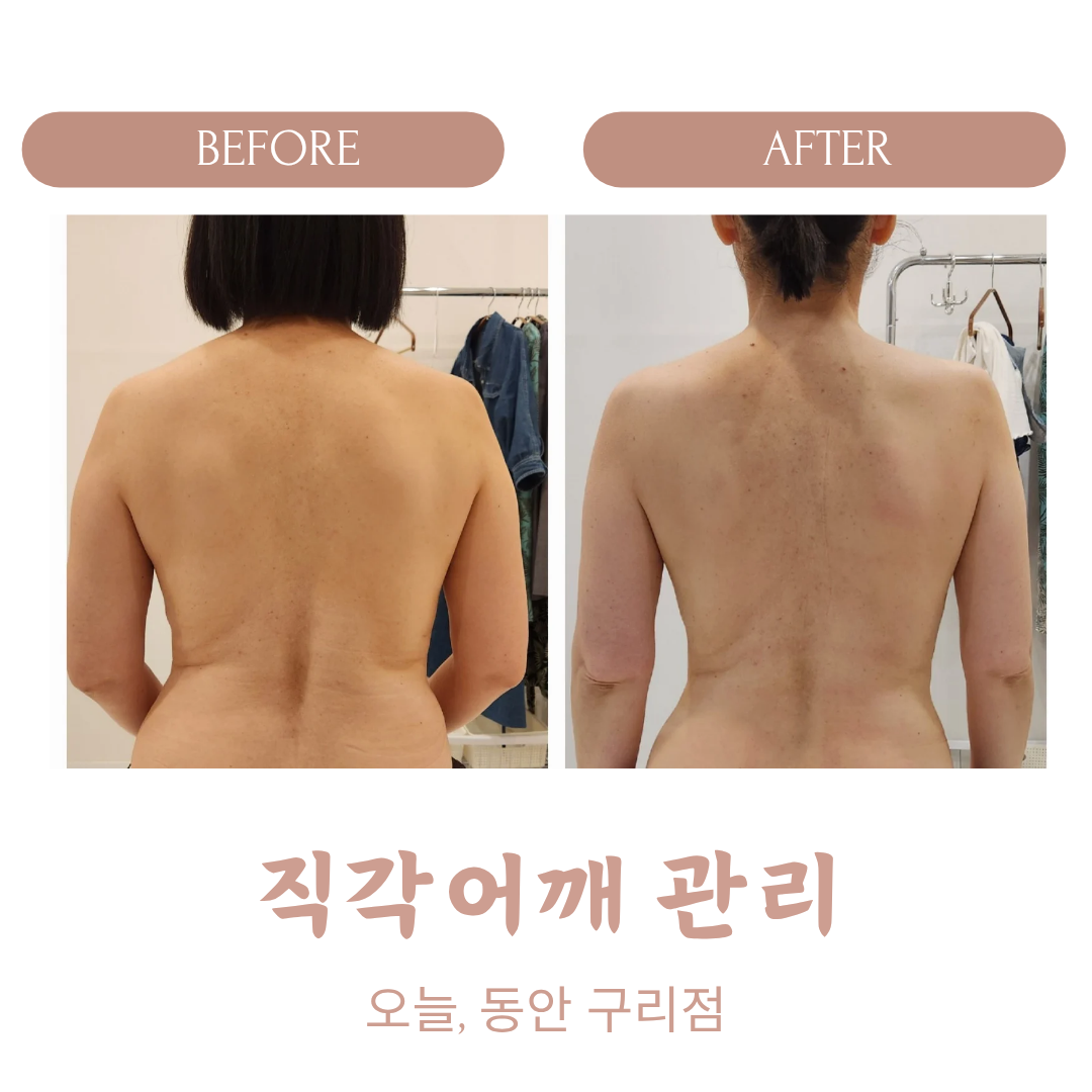 오늘, 동안 구리점 photo 3