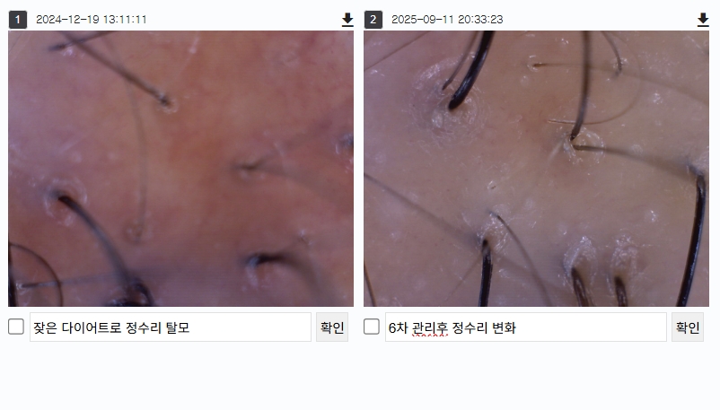 헤드스파 크리시모 대표 이미지