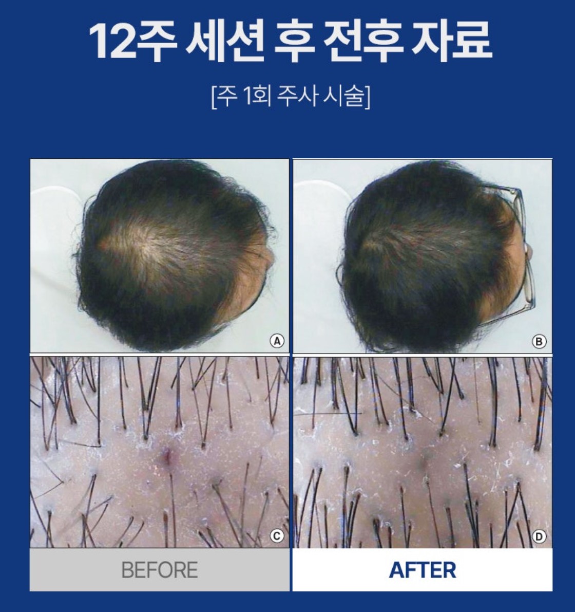 스페이스아델라 대표 이미지