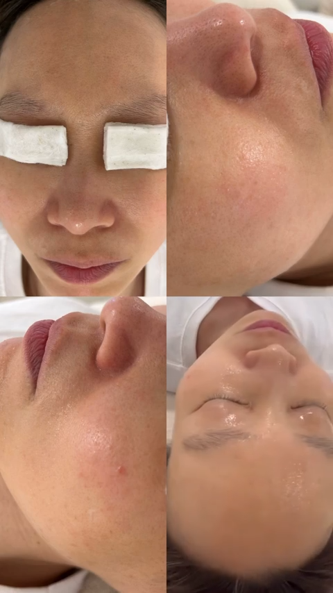 더고운피부에스테틱 대표 이미지