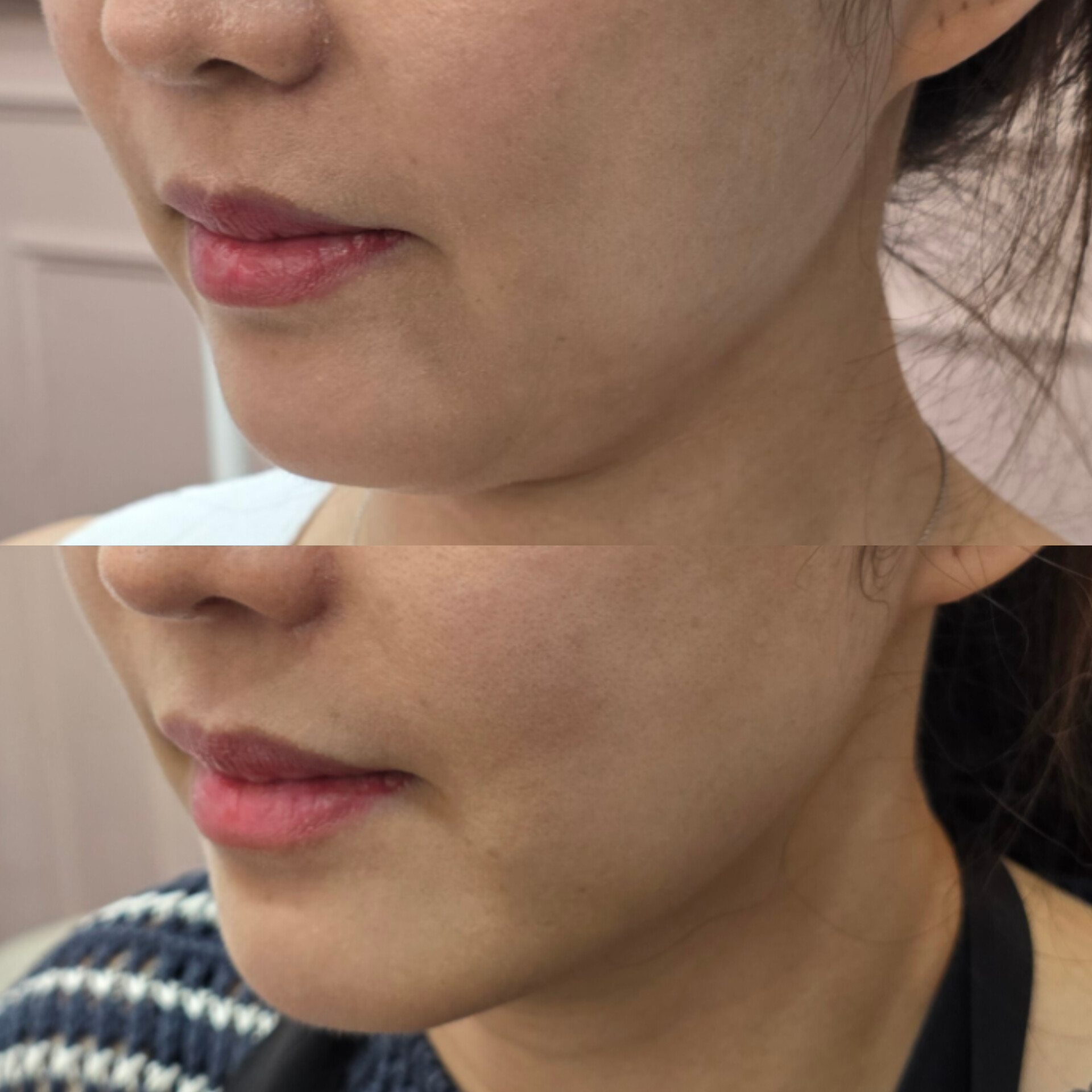 엘브라운 눈썹 & 피부 대표 이미지