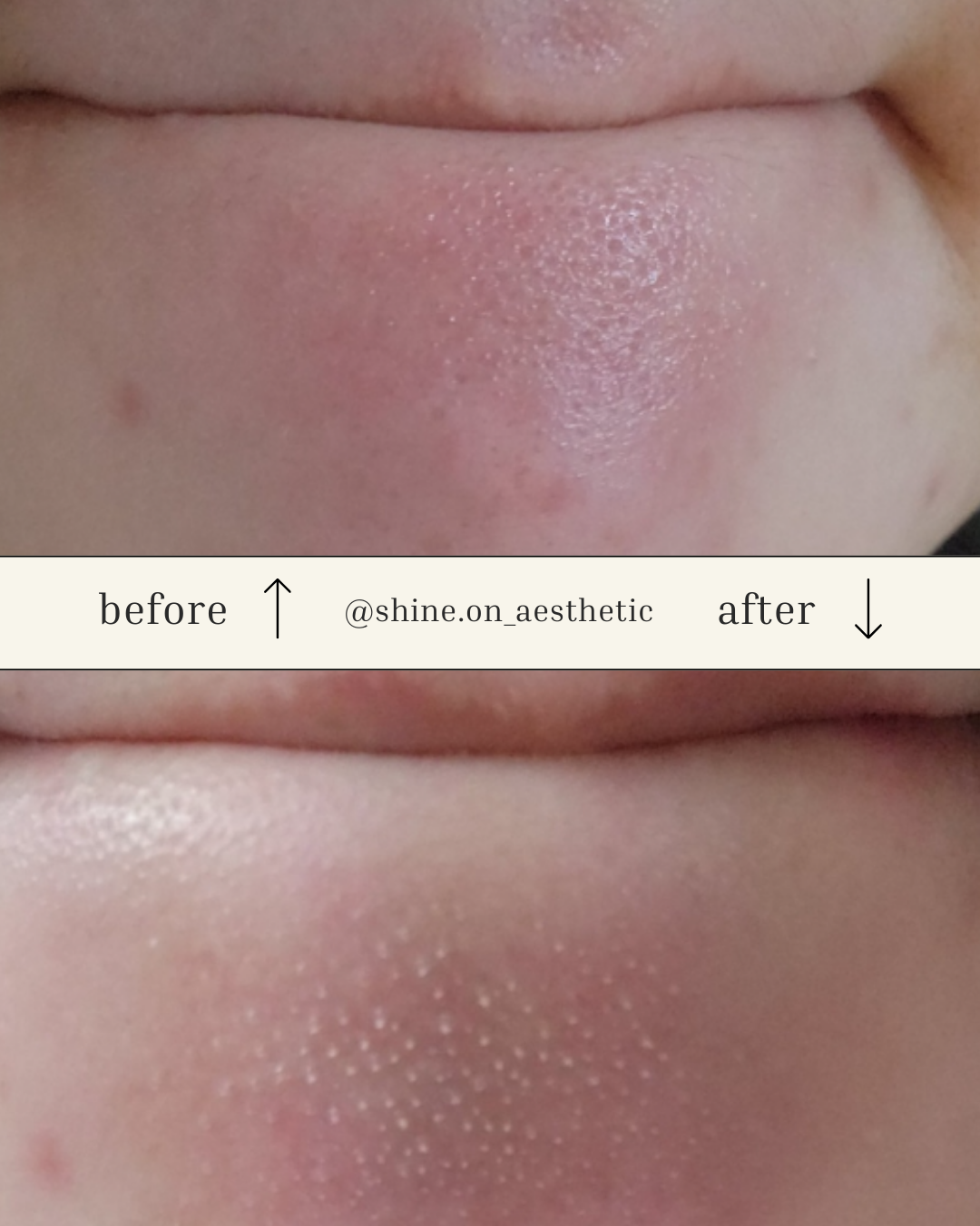 샤인온에스테틱 대표 이미지