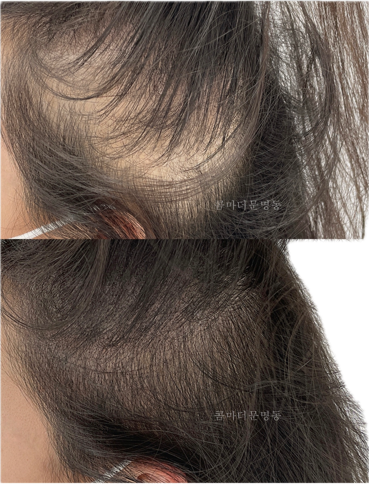 콤마더문 명동 대표 이미지