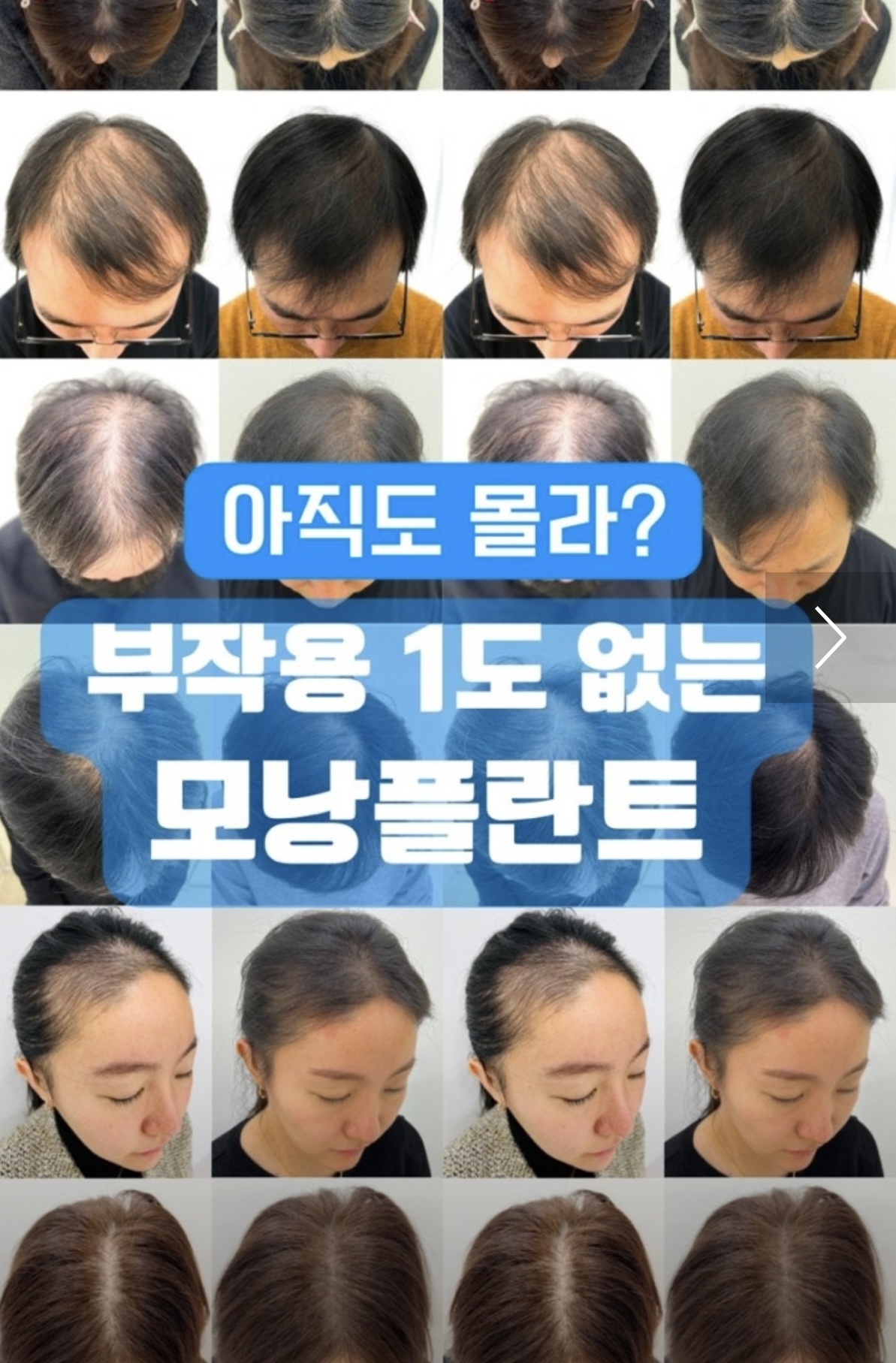 모리셋두피재생센터 서초점 대표 이미지