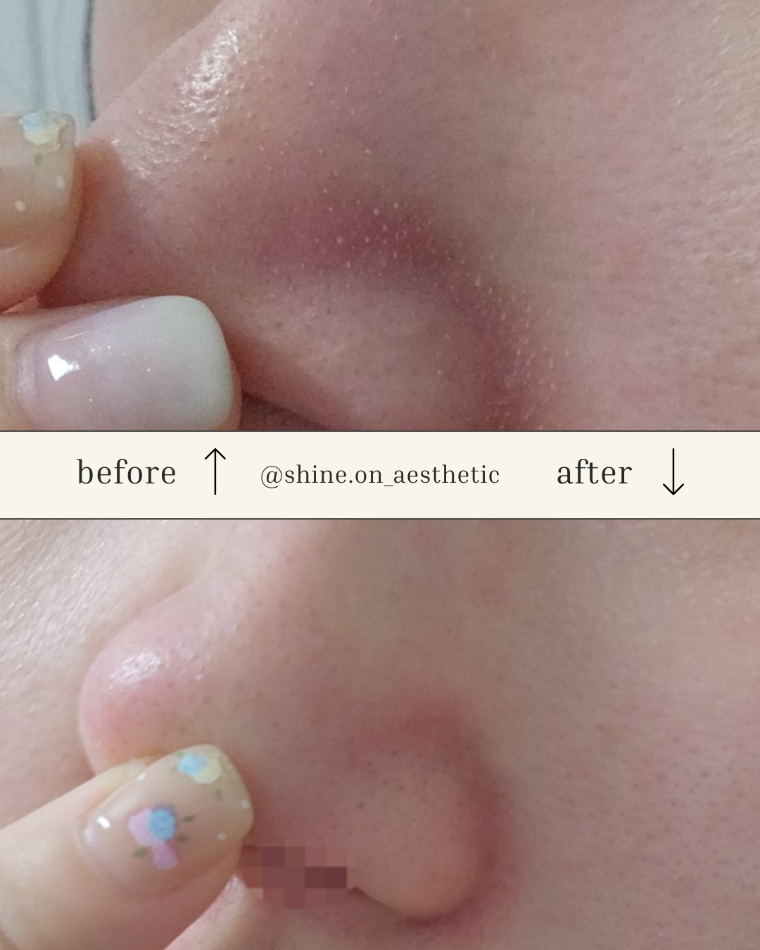 샤인온에스테틱 파주운정점 대표 이미지