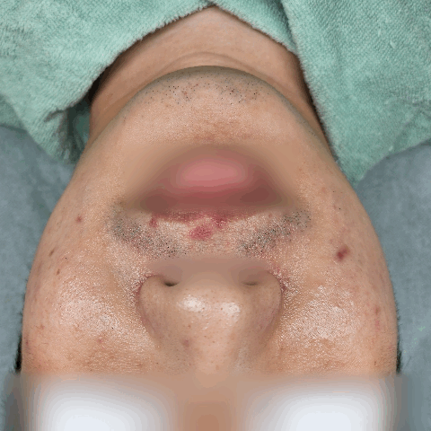 스킨리프 대표 이미지