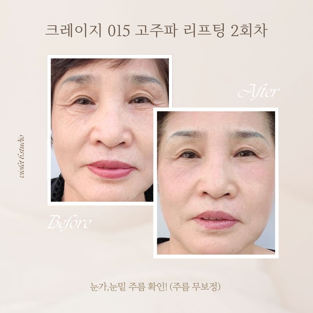 상봉 바이올렛 이미지