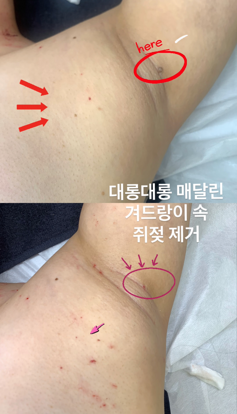 아보하더실 대표 이미지