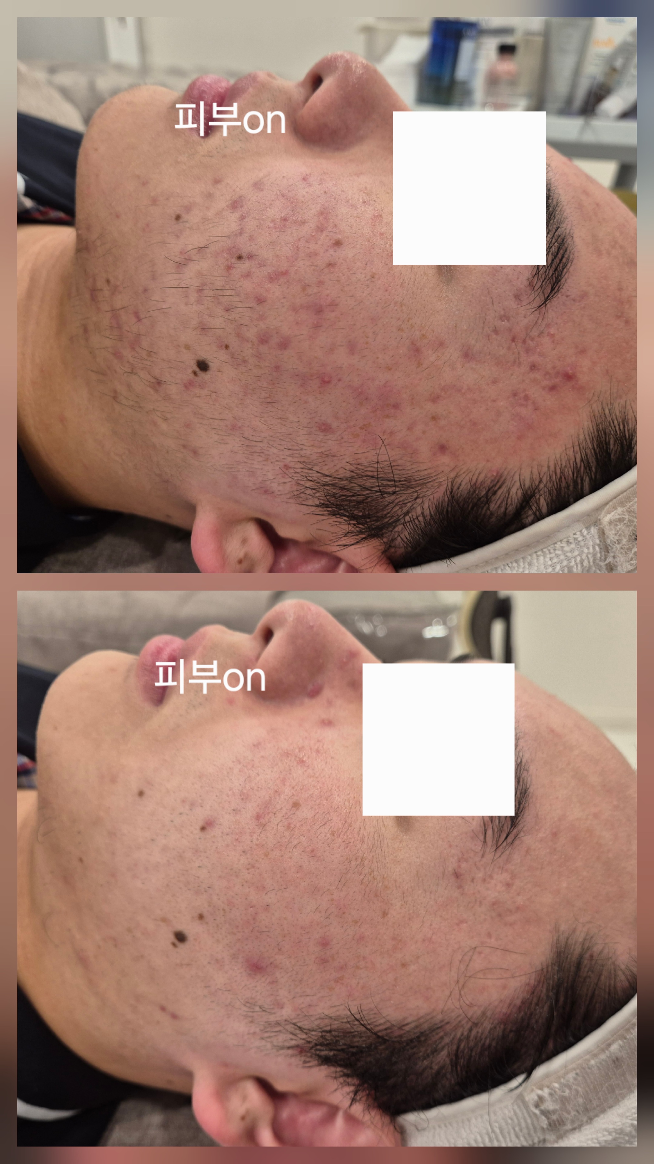 피부ON 대표 이미지