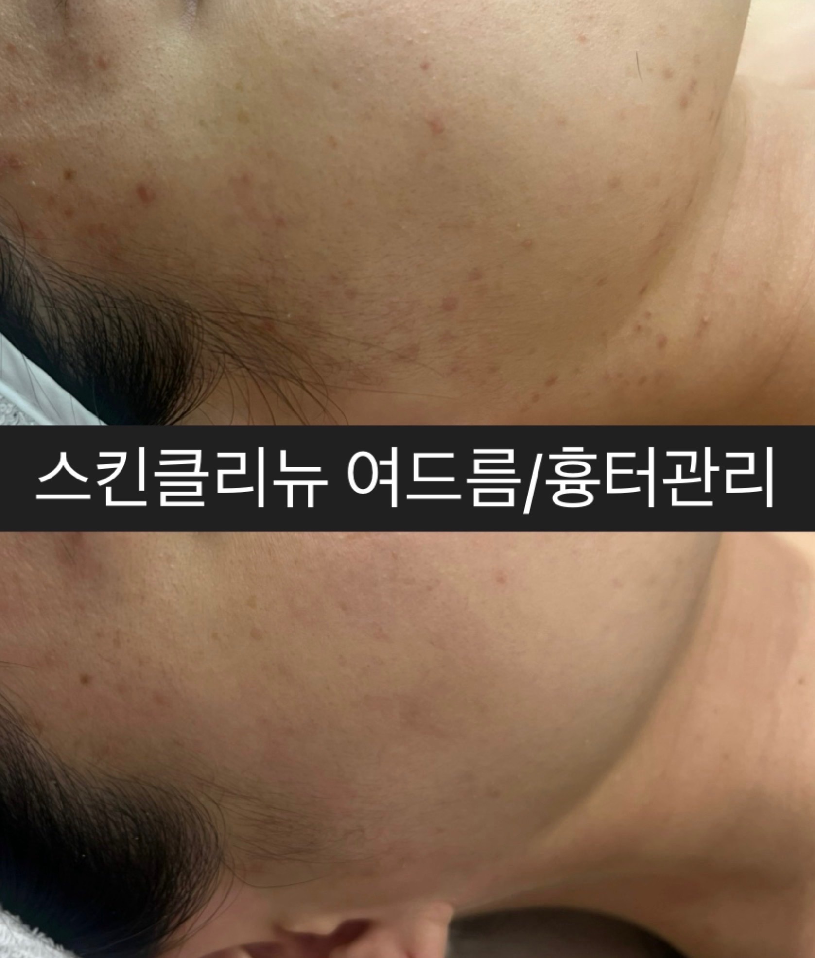 스킨클리뉴 대표 이미지