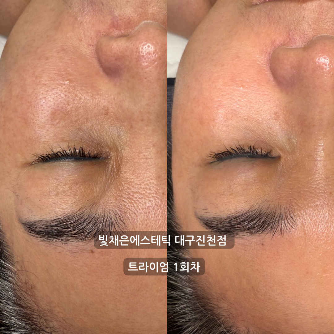 빛채은에스테틱 대표 이미지
