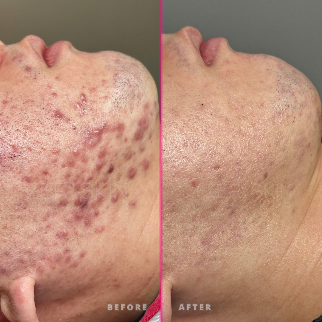 제로스킨 홍대 대표 이미지