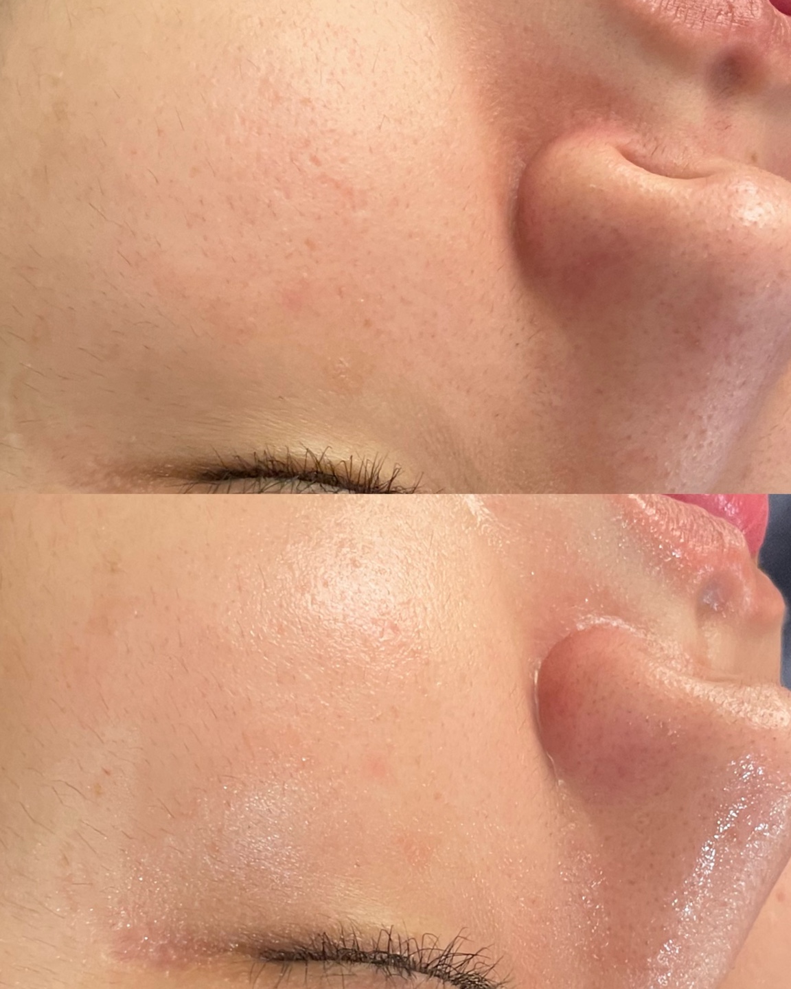 모브스킨 대표 이미지