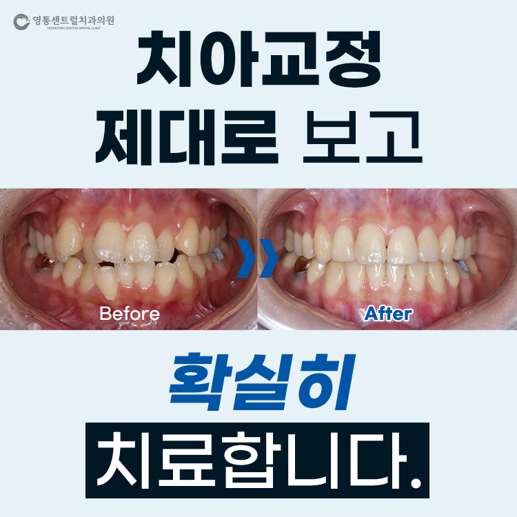 영통센트럴치과의원 대표 이미지
