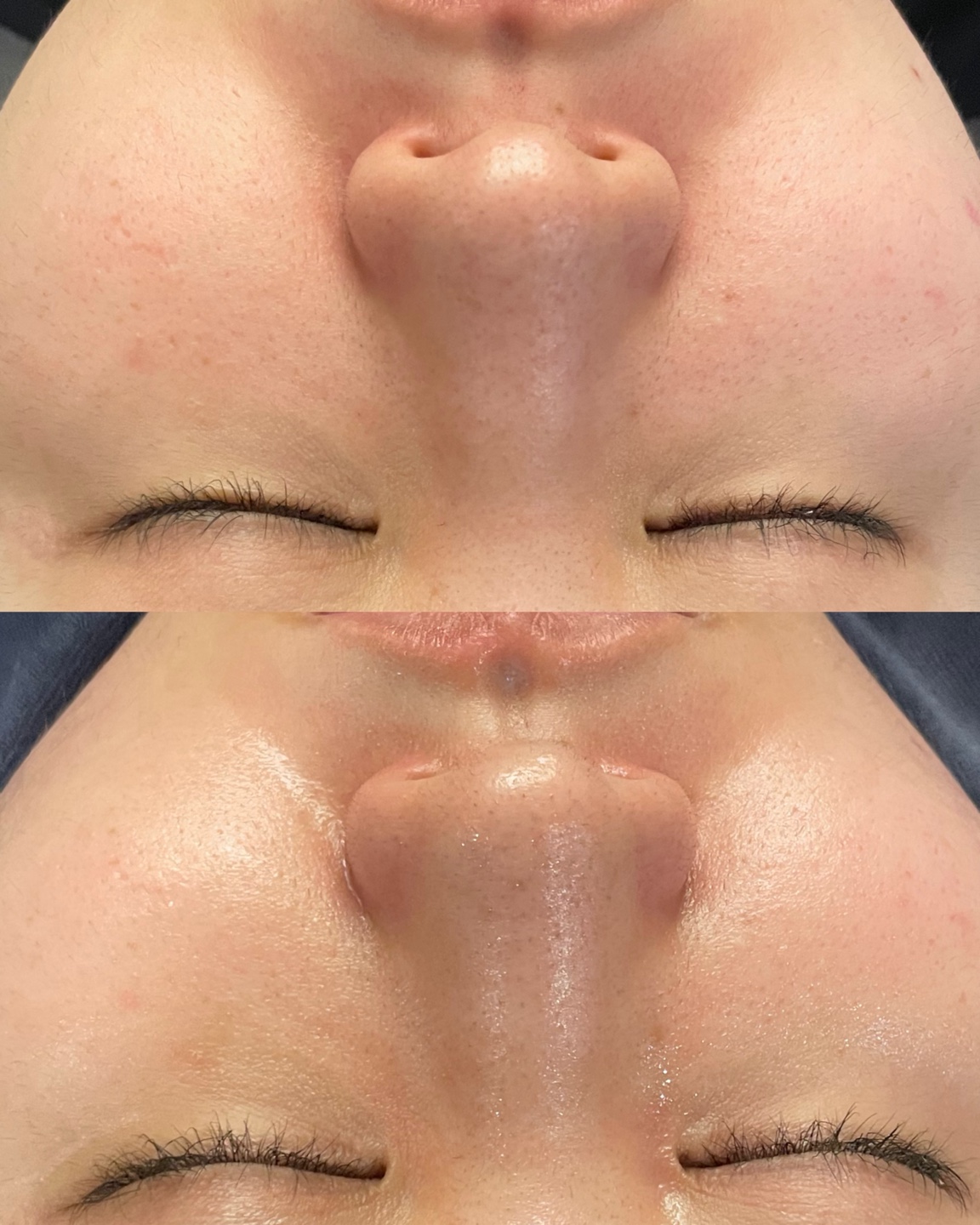 모브스킨 대표 이미지