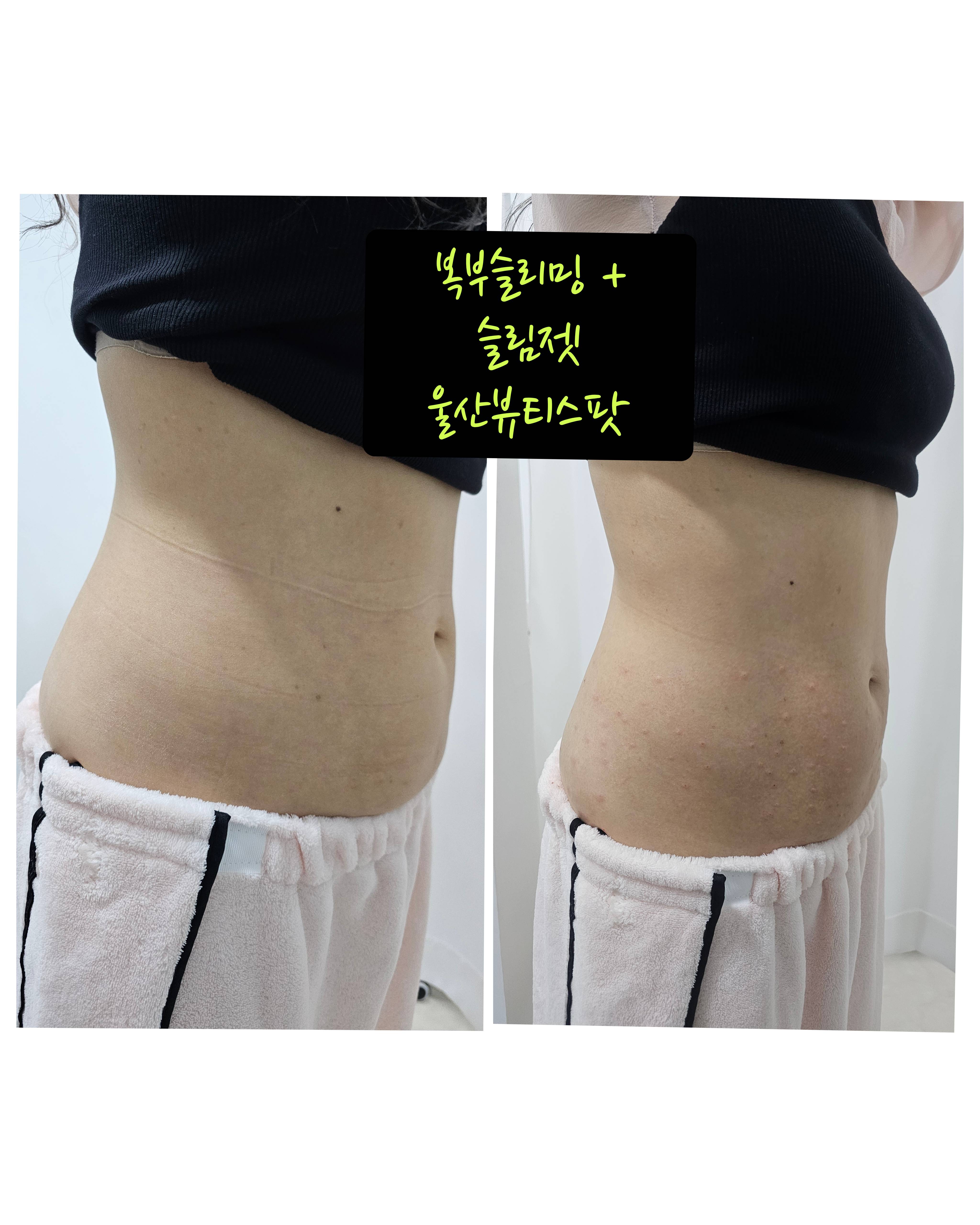 뷰티스팟 왁싱스팟 대표 이미지