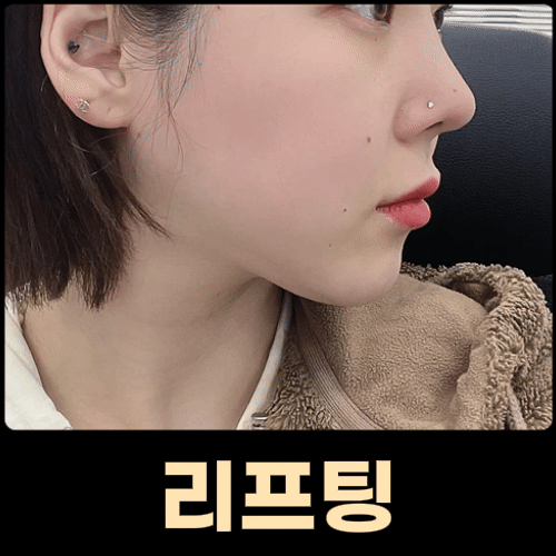 더프라이드성형외과의원 대표 이미지