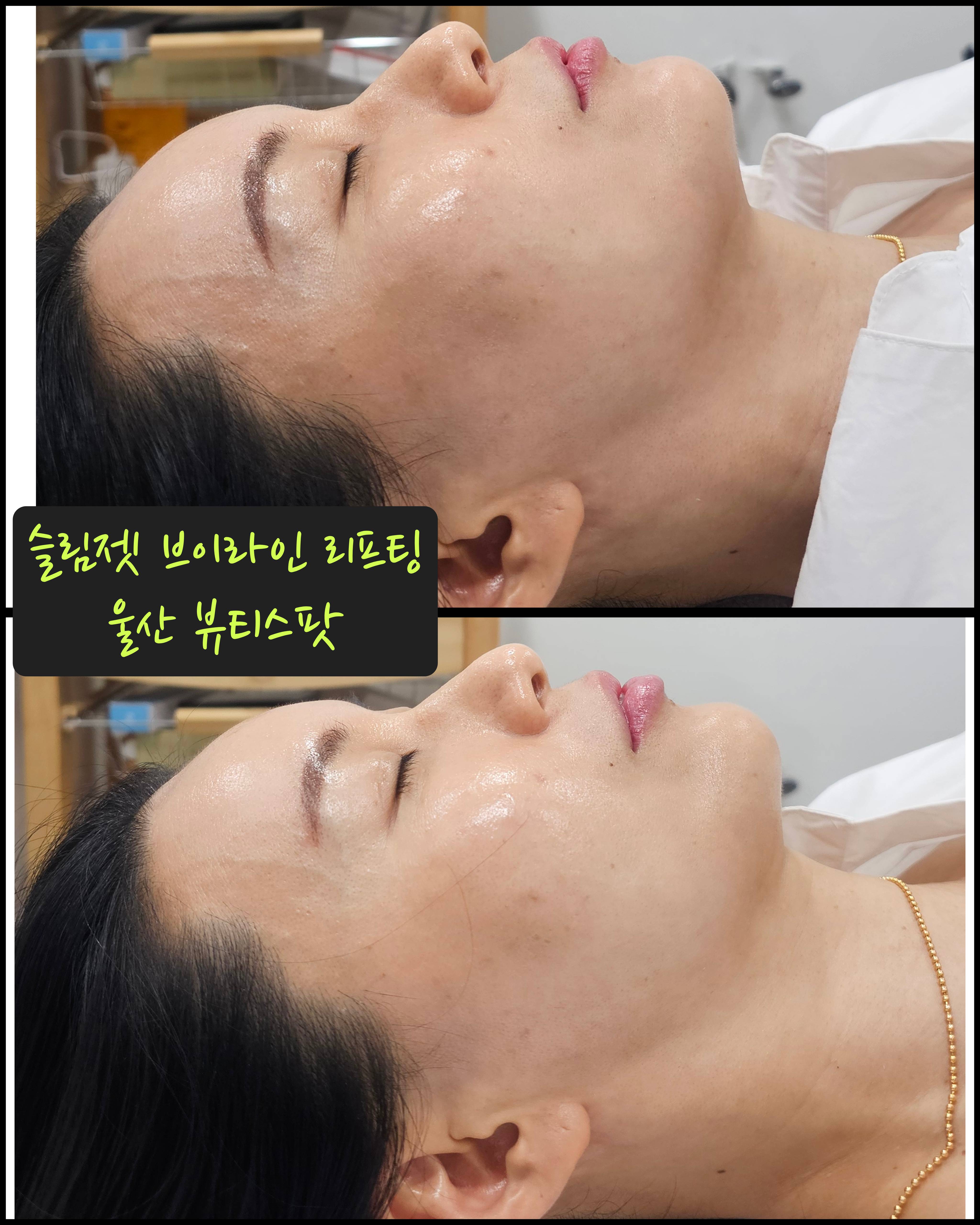 뷰티스팟 왁싱스팟 대표 이미지