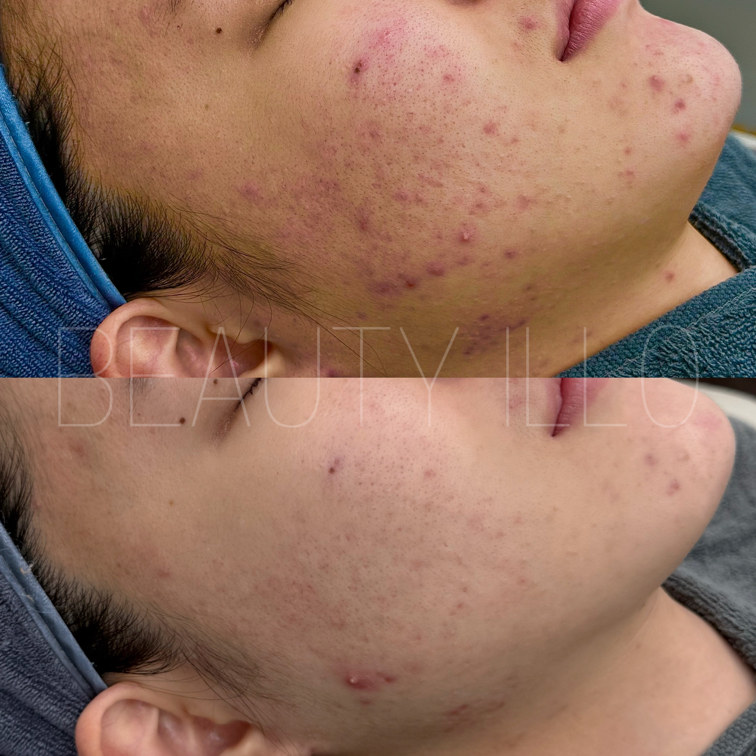 뷰티일로 대구본점 대표 이미지