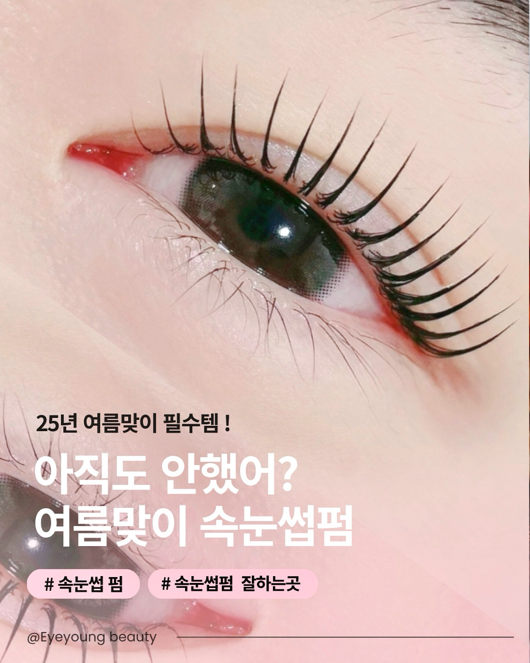 아이 영 대표 이미지