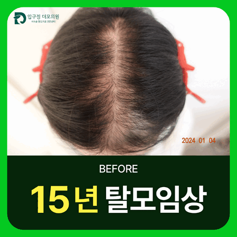 압구정더모의원 대표 이미지