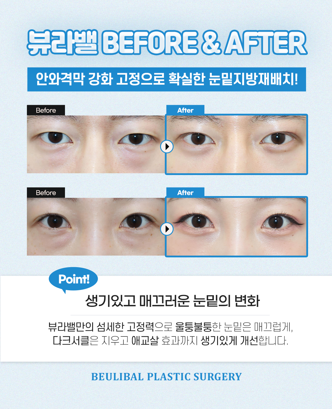 뷰라밸성형외과의원 대표 이미지