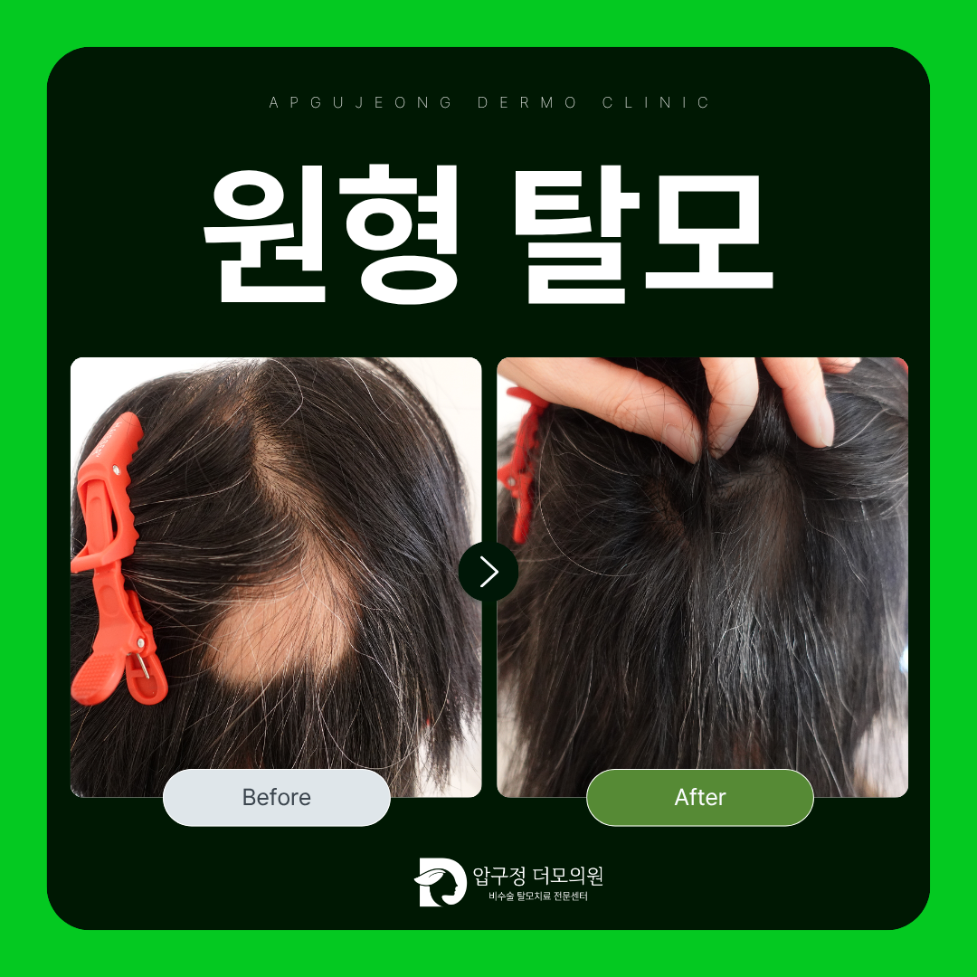 압구정더모의원 대표 이미지